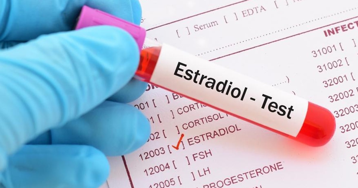 Estradiol - czym jest, przebieg badania, normy, wskazania. Jak ...