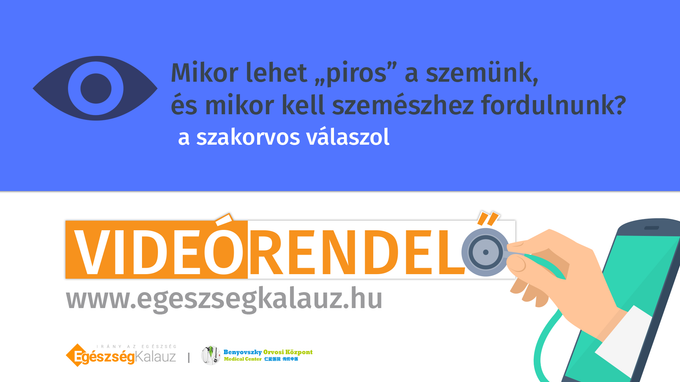 Mikor lehet "piros" a szemünk, és mikor kell szemészhez fordulnunk?