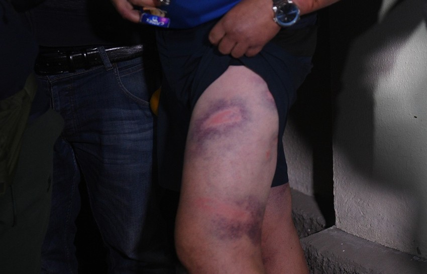 Pretučeni demonstranti iz Minska