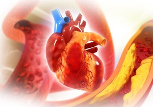Arterije su krvni sudovi koji prenose krv bogatu kiseonikom kroz telo