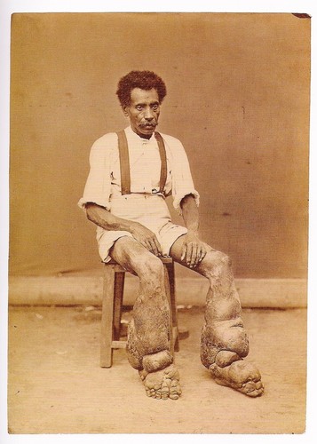 Jdno ze zdjęc w zbiorach Mutter Museum