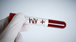HIV nu este o condamnare la moarte.  Metode moderne de tratament al virusului imunodeficienței dobândite
