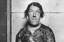 Zovu je NAJRUŽNIJA ŽENA U ISTORIJI, ona rođena kao LEPOTICA pa ju je ova bolest IZOBLIČILA: Nastupala u cirkusu i trpela PONIŽENJA da bi njena deca preživela