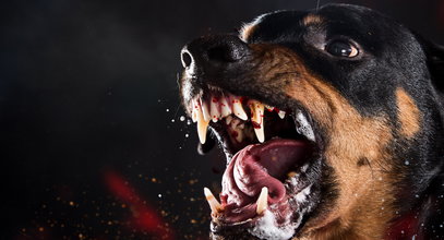 Horror w domu pomocy. Rottweiler uciekł ze spaceru, by zaatakować wolonariuszkę