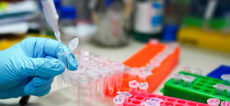 Włoski ekspert: Liczba przypadków zakażeń może wzrosnąć do kilkudziesięciu tysięcy dziennie