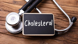 Mity na temat cholesterolu – komu zagraża, leczenie statynami, dieta