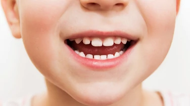 Chcesz, żeby dziecko miało proste zęby? Nie przegap tych objawów