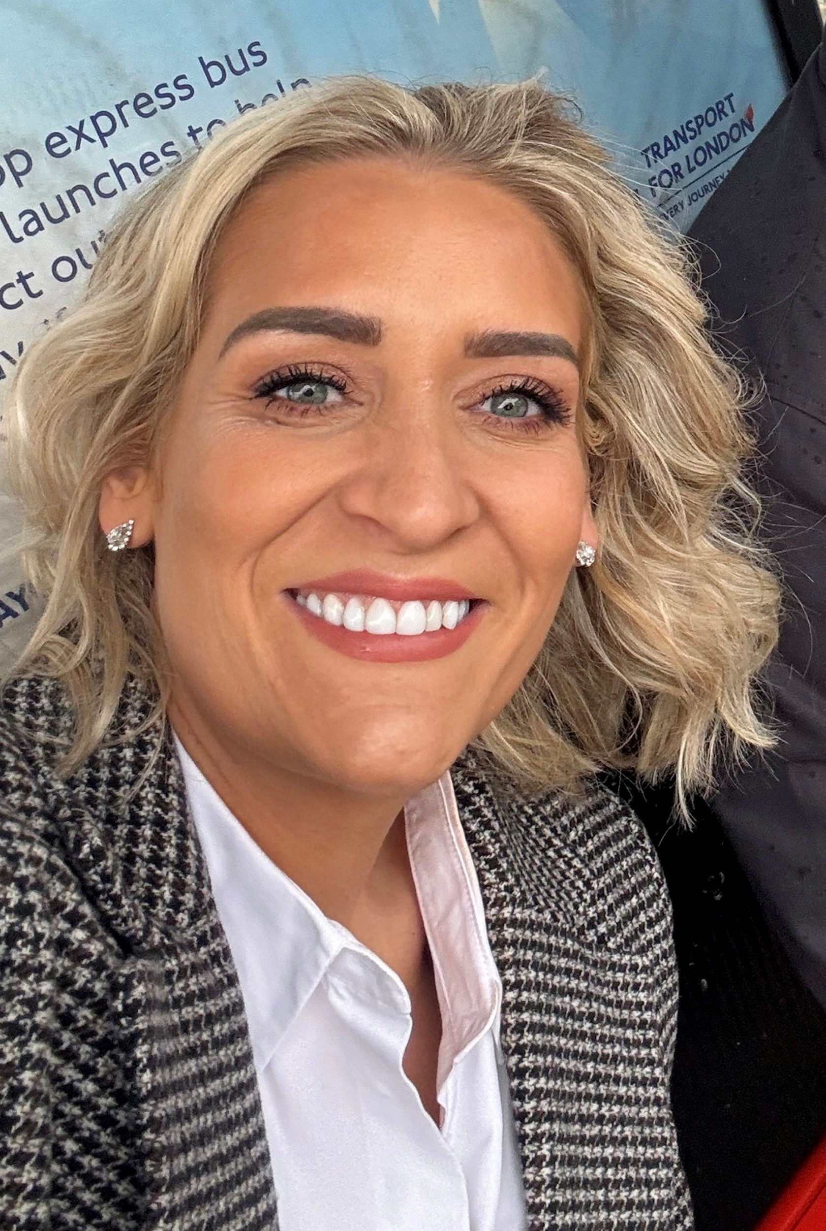 Katie Carrington oslepla na jedno oko.