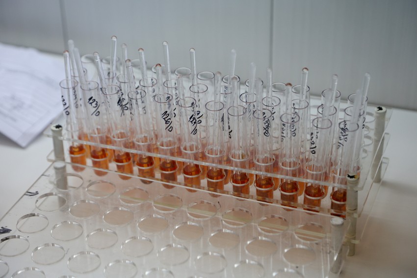 Na urinarne infekcije ukazuje neobičan miris i boja urina