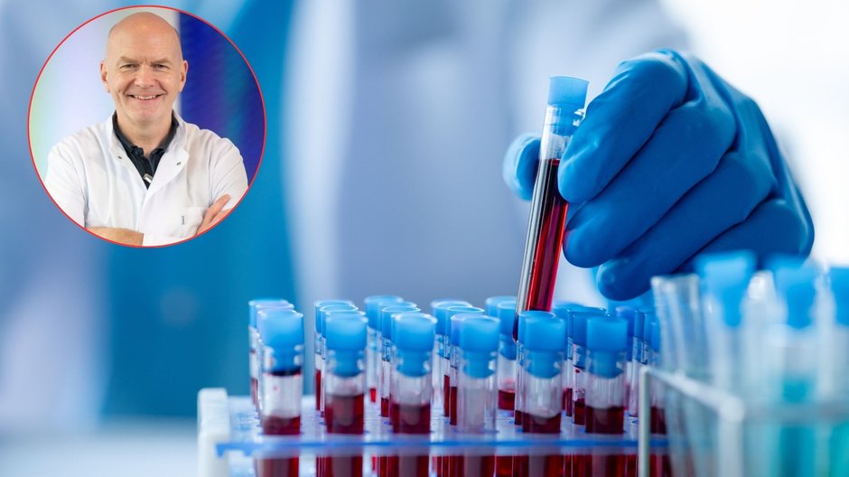 Podaj Przykład Choroby Którą Można Wykryć Za Pomocą Testów Pourodzeniowych Badania krwi pozwolą wykryć nowotwór? Naukowcy testują rewolucyjne