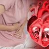 Najveći rizik imaju žene sa PMOS-om i endometriozom 