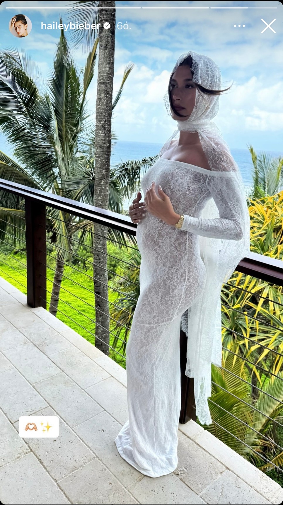 Hailey Bieber első gyermekét várja