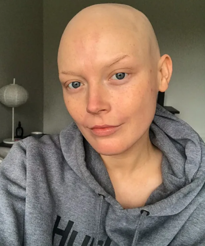 Georgie diagnostikovali Hodgkinov lymfóm.