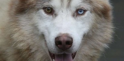 Husky ugryzł roczną dziewczynkę w twarz!