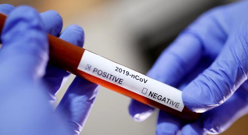 189 test positive for Covid-19