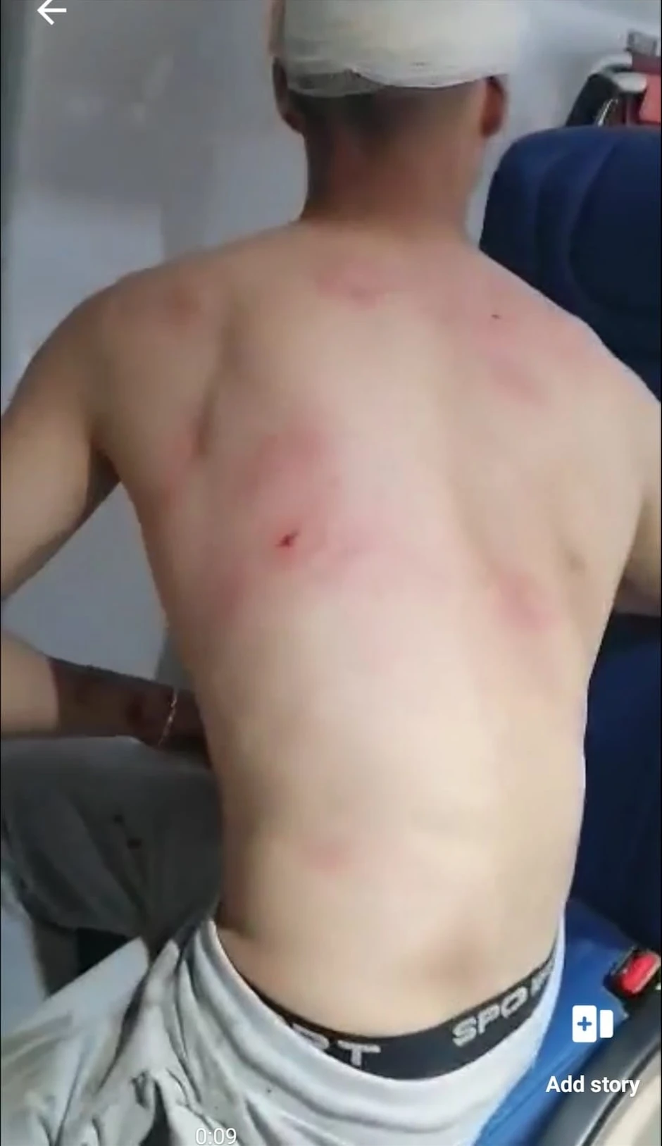 Dečaka su tukli kaiševima po telu