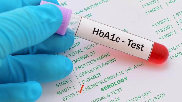 Mit jelent HbA1c érték laborlelet