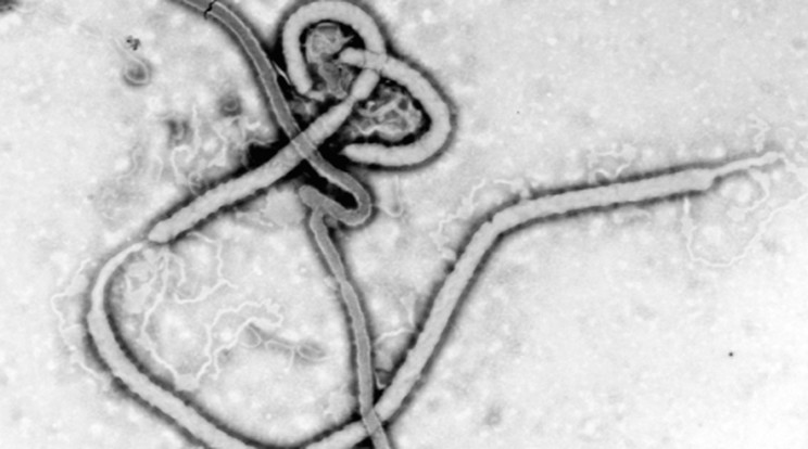 Sierra Leonéban már a harmadik orvossal végzett az ebola