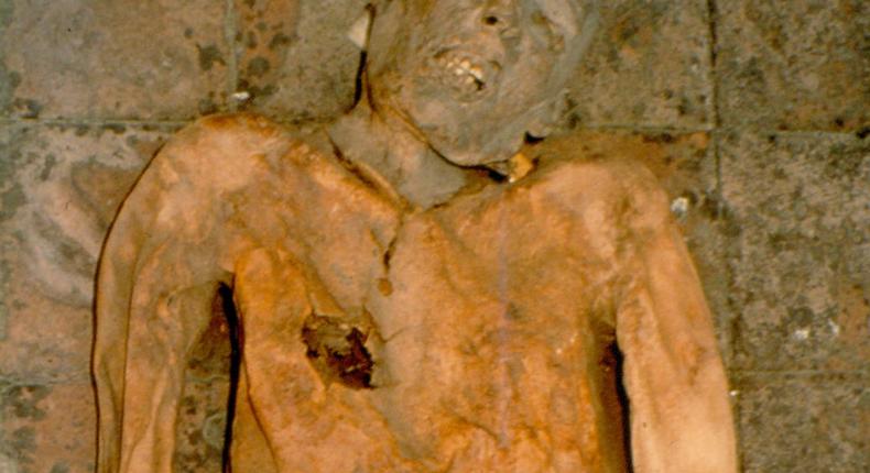 Researchers studied the mummified remains of an Italian nobleman. He died in 1586, from what is thought to be chronic gallbladder inflammation from gallstones.