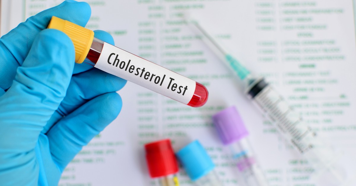 ¿Qué significa colesterol no HDL alto?  Cuanto menos, mejor