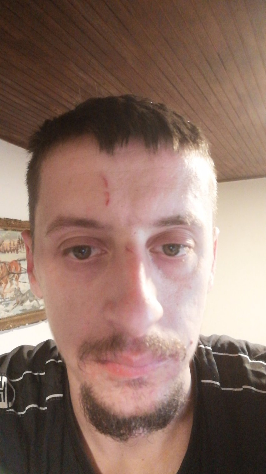 Mićo Marković je bolje prošao, ali je šok i dalje prisutan