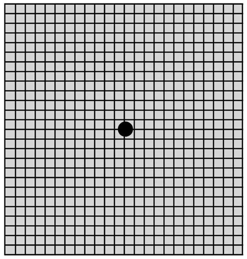Do wstępnej oceny prawidłowości widzenia wykorzystuje się siatkę Amslera.