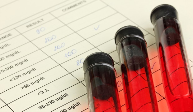 Trombocitopenija se javlja kada koštana srž ne proizvodi dovoljno trombocita - krvnih zrnaca koje pomažu u zaustavljanju krvarenja