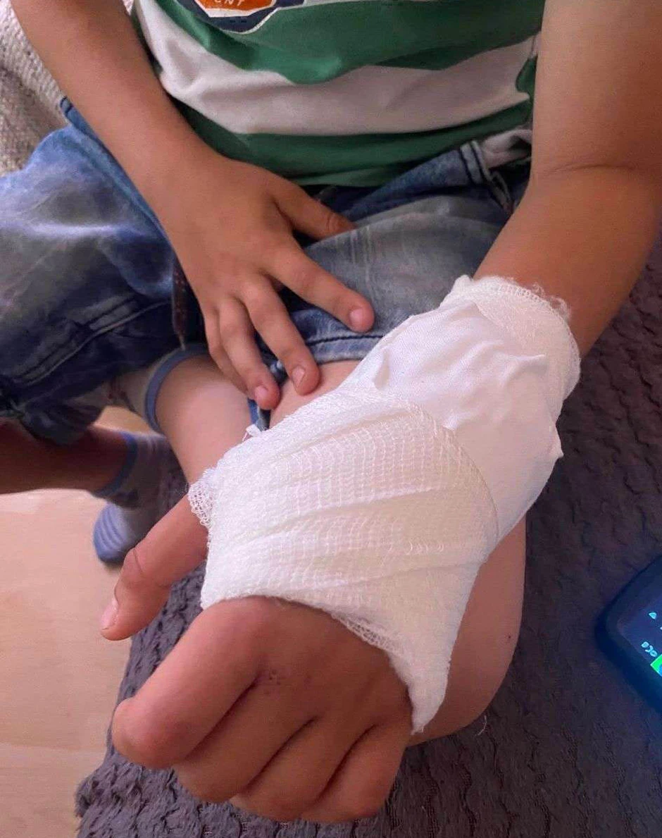 Fotografija povreda dečaka koje nam je dostavila njegova majka