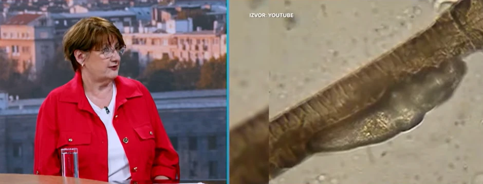 Oporavak kožne barijere je najvažniji korak u lečenju svake kožne bolesti, a pogotovo ove koja je prouzrokovana mikroorganizmima koji treba da čine prirodni zaštitni sloj, kaže dr Kozarev