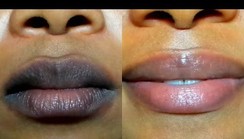 Natural Remedies: 5 natural ways to get pink lips