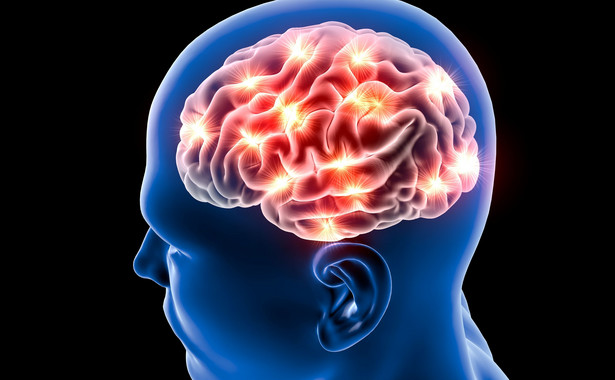 Nowatorska metoda leczenia udaru mózg: trombektomia