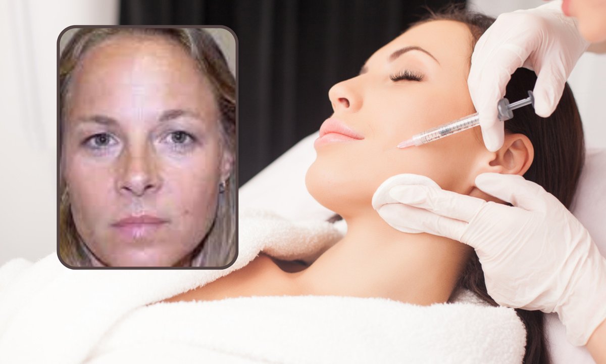 Jedna stosowała botoks przez 13 lat, druga nie. Bliźniaczki są nie do poznania [zdjęcia]