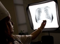 Ilu Polaków choruje na gruźlicę?