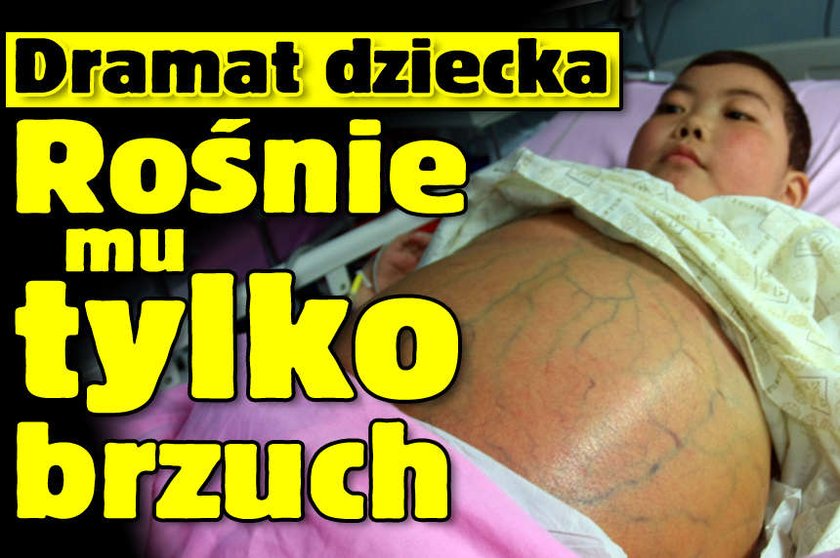 Dramat dziecka. Rośnie mu tylko brzuch