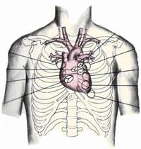 Ischaemiás szívbetegség, stabil koszorúér-betegség, angina pectoris - PDF Ingyenes letöltés