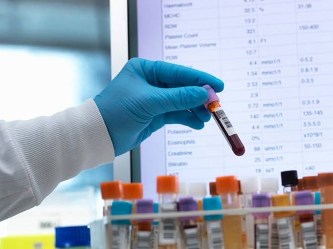 Doktor objašnjava kako da tumačimo krvnu sliku