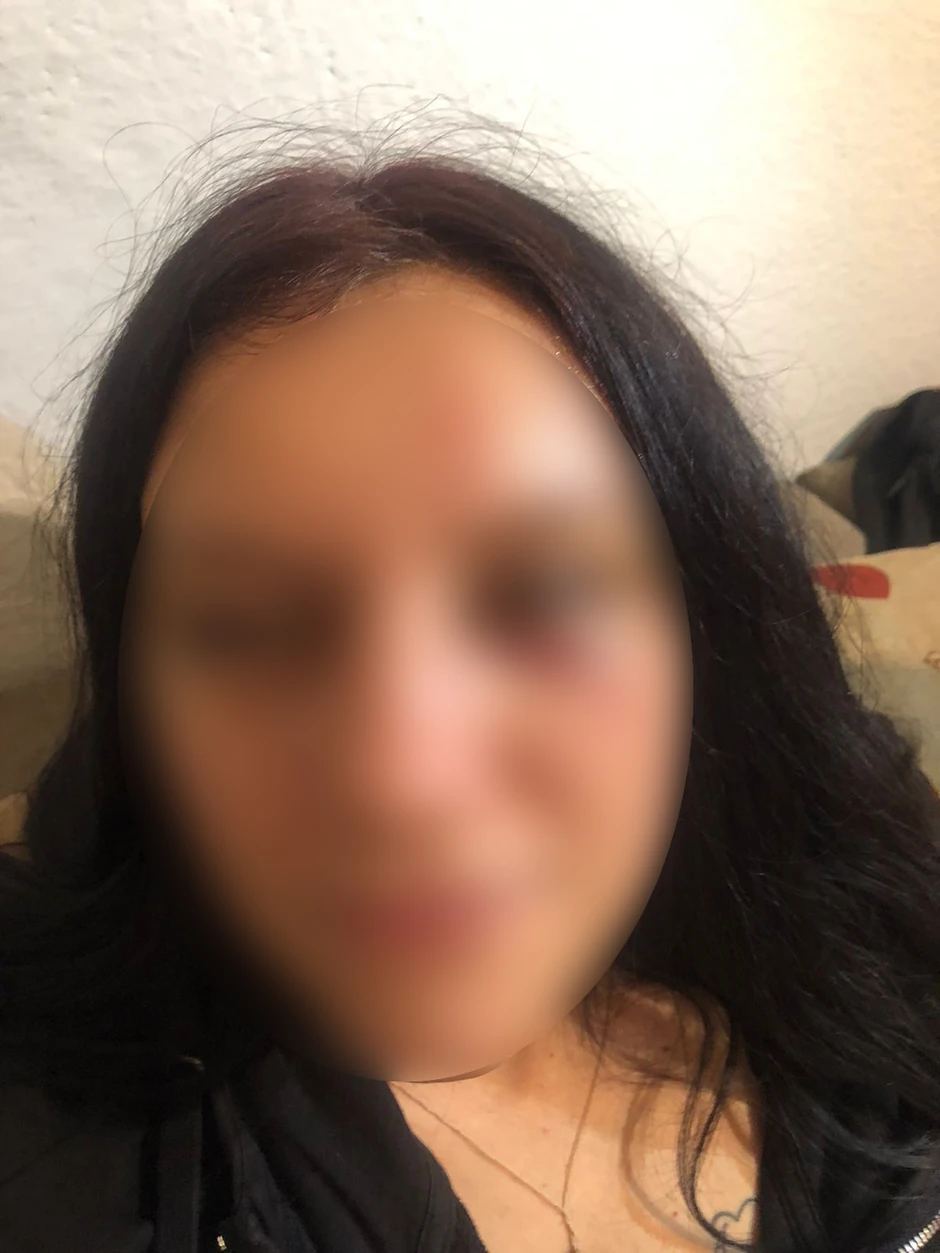 Srpkinja pretučena u Beranama