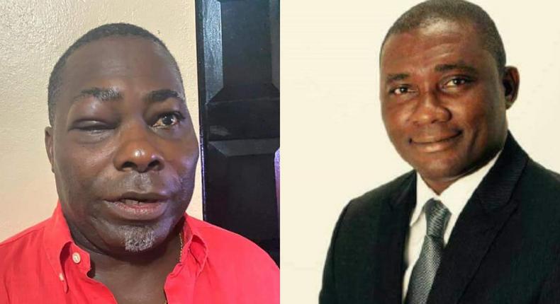 ‘He threw the first blow’ – MP Mireku explains fight with Charles Bissue