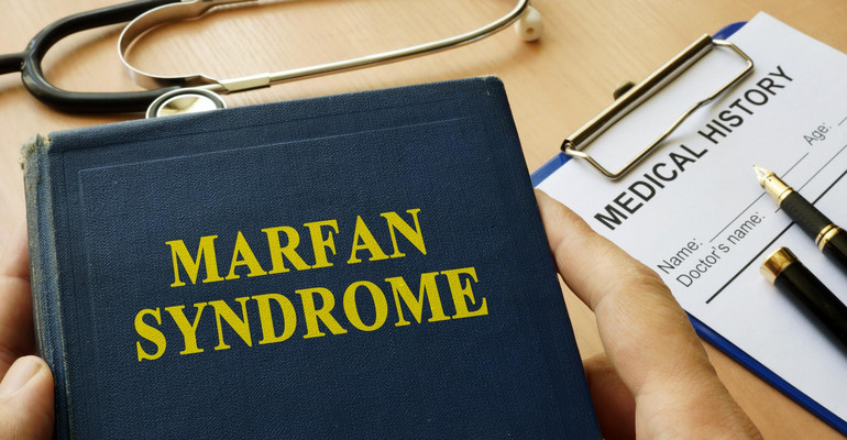 Zespół Marfan - choroba długich i słabych rąk