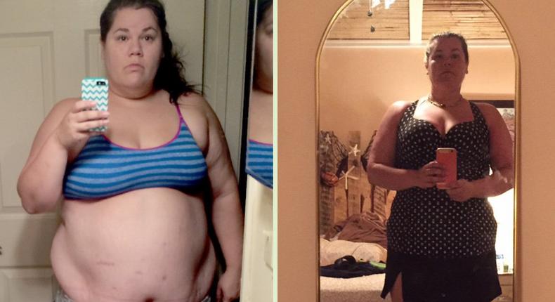 '9 things I wish I knew about gastric bypass surgery before I had it’