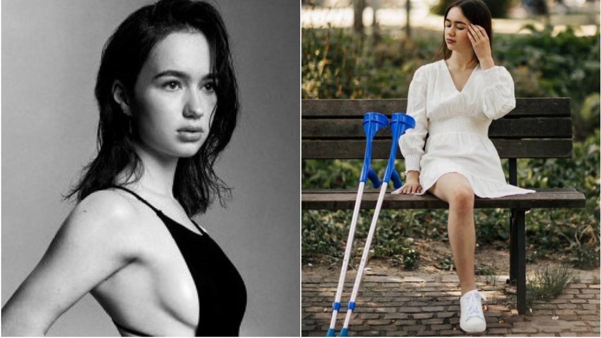 20-latnia Nastia z Ukrainy:  "Straciłam nogę, ale nie straciłam siebie"