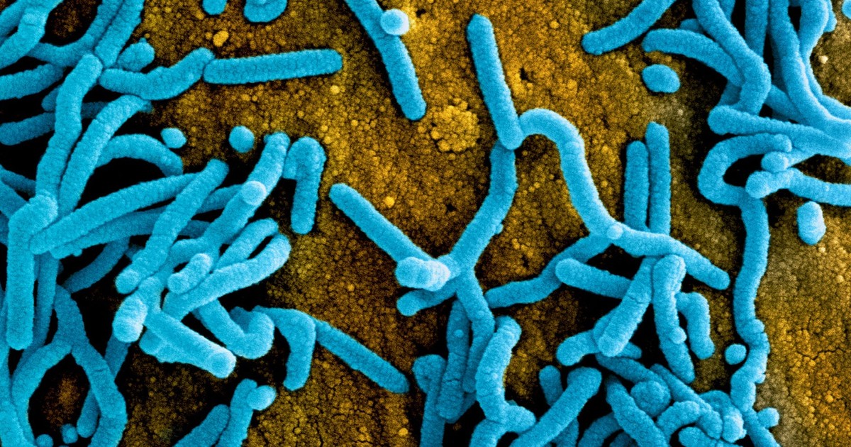 Ghana declares outbreak of Marburg virus, a deadly and contagious disease like Ebola which officials are trying to contain - Vimarsana News
