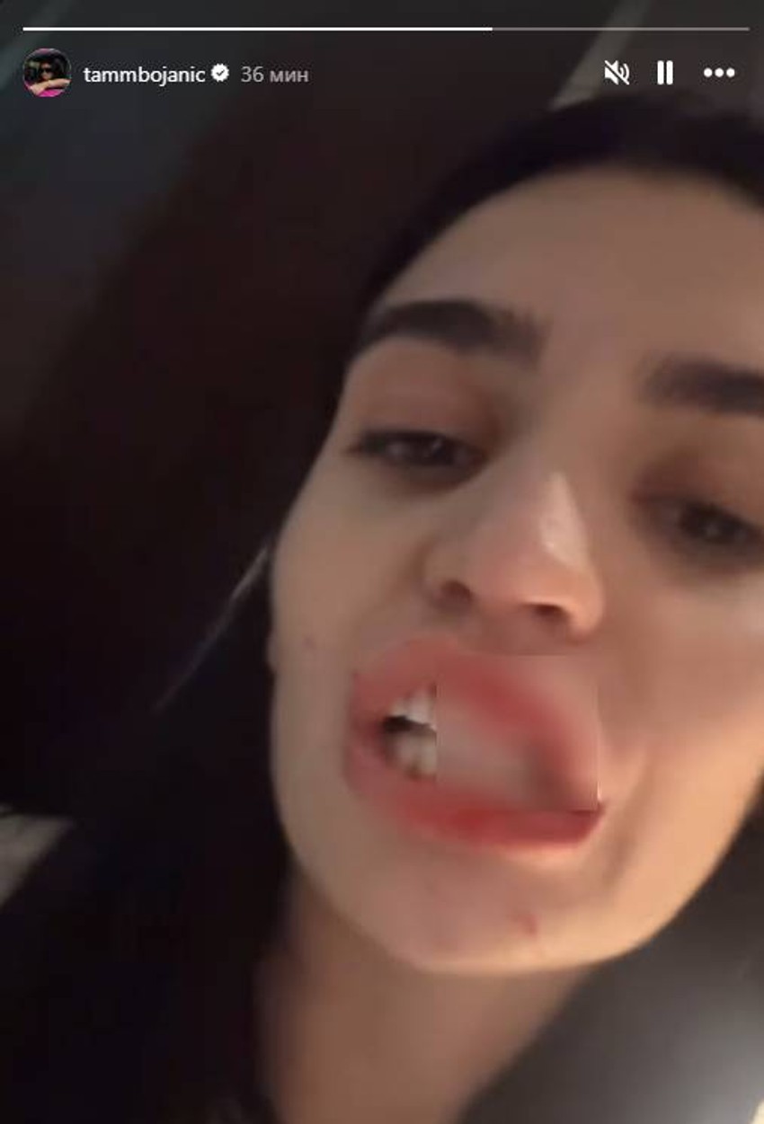 Tamara Bojanić pretučena