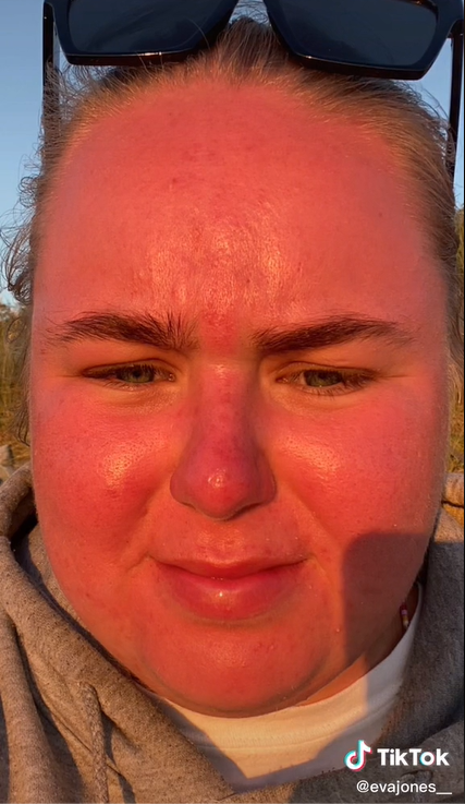 Eva neverila, že hodina na slnku dokáže niečo spraviť.
