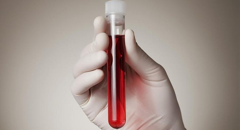 Could a simple blood test determine when you’ll die?