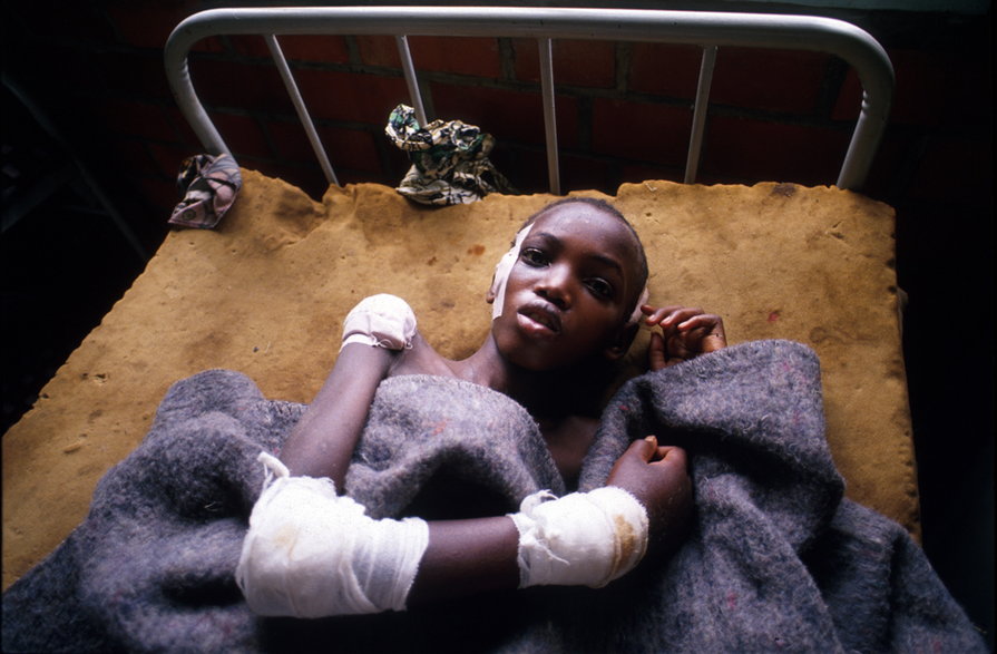 Dziecko Tutsi ocalałe z masakry w 1994 r.