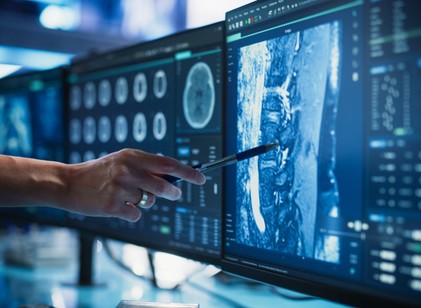 Ezért egyre több a daganatos megbetegedés minden korosztályban című cikk nyitóképe