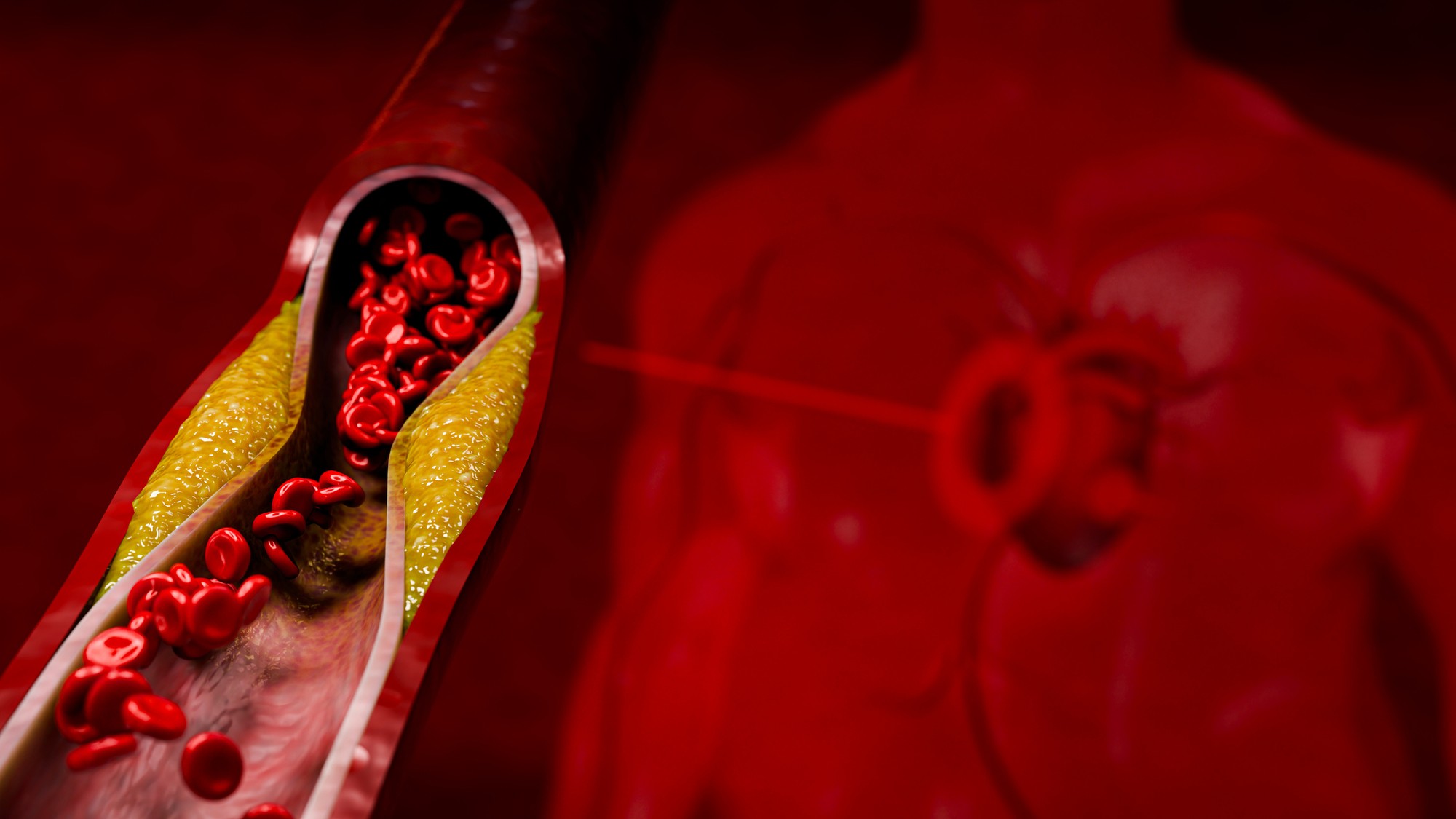 Vysoký cholesterol môže zanechať stopy aj na pokožke: Na ktoré prejavy upozorňujú odborníci? Ilustračná fotografia