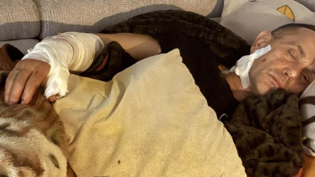 Psi lutalice napale bivšeg specijalca