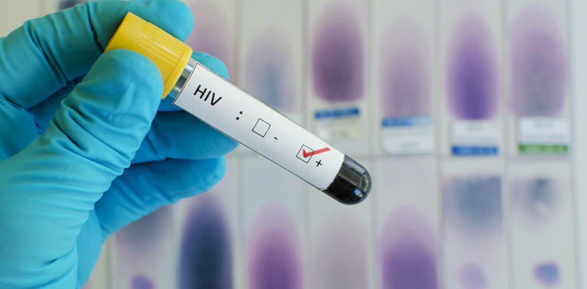 Epidemia HIV? W Polsce coraz więcej zakażonych wirusem!